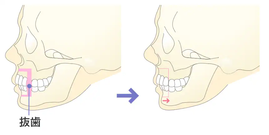 bone-cut