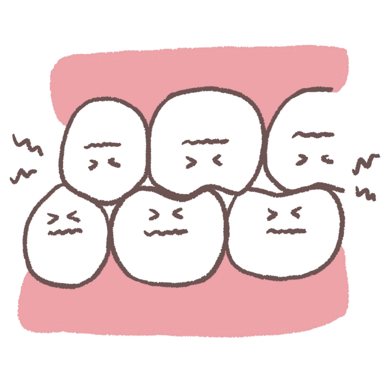 bruxism